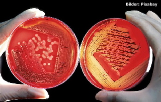 agar-60571_1280